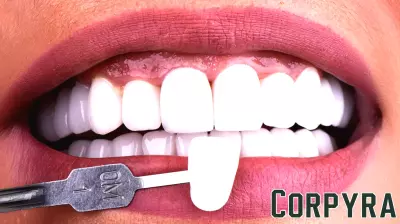 The Rise of No-Prep Veneers: The Latest Trend in Cosmetic Dentistry